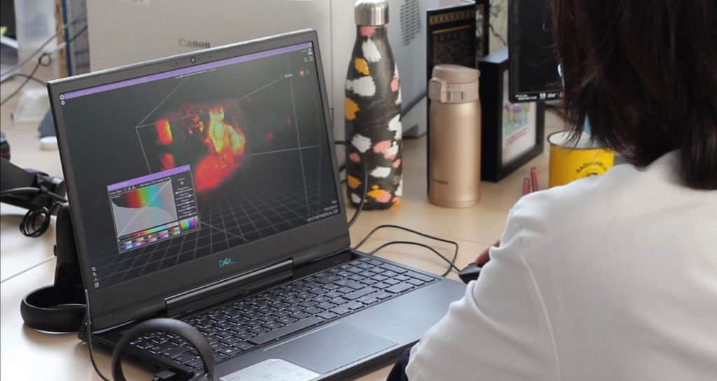 A clinician in a white coat at a desk in a radiology office, working on a laptop that shows a colour-mapped volumetric reconstruction with a transfer-function panel open beside it, a VR headset on the desk
