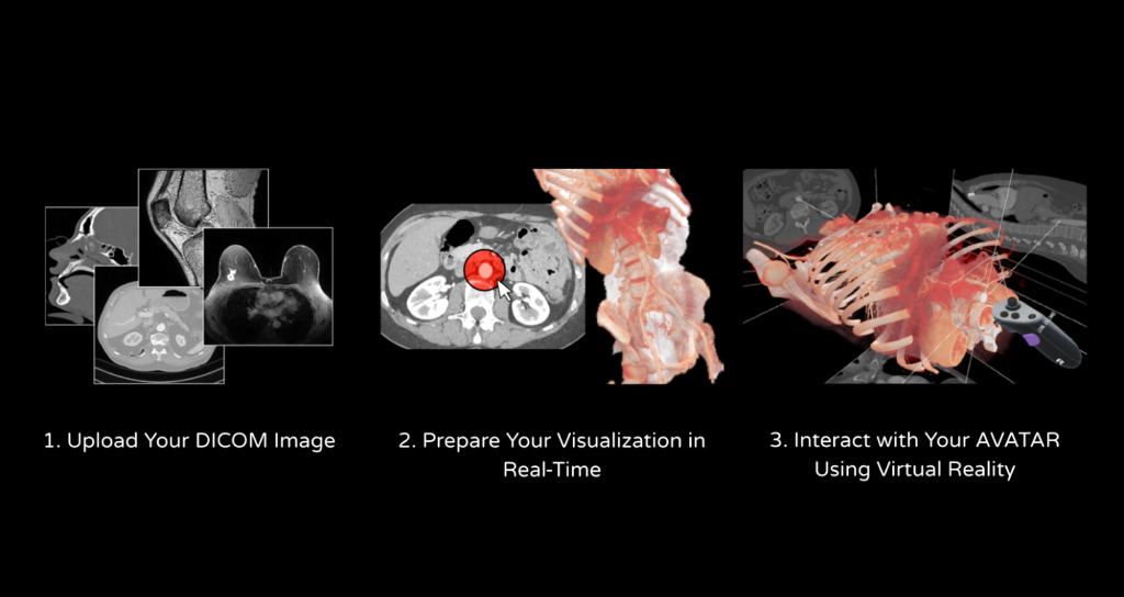 Three-step product diagram: uploading DICOM images, preparing a real-time visualisation with a marked structure on an axial section next to the reconstruction, and interacting with the resulting avatar in virtual reality with a hand controller
